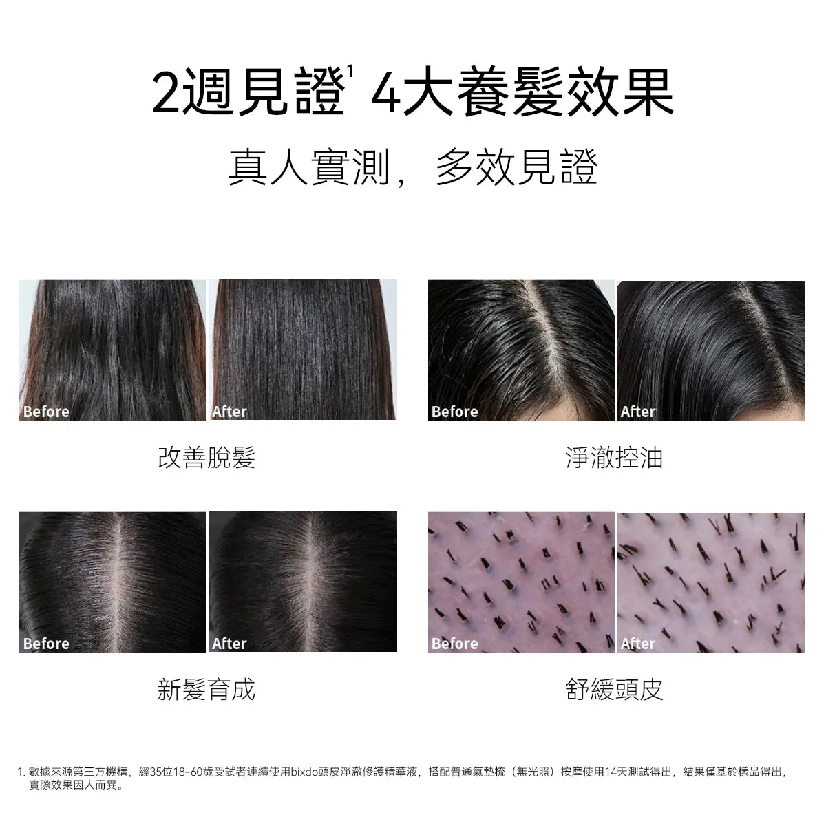 bixdo倍至頭皮精華液 60ml 控油強韌 煥活毛囊 光養梳搭檔